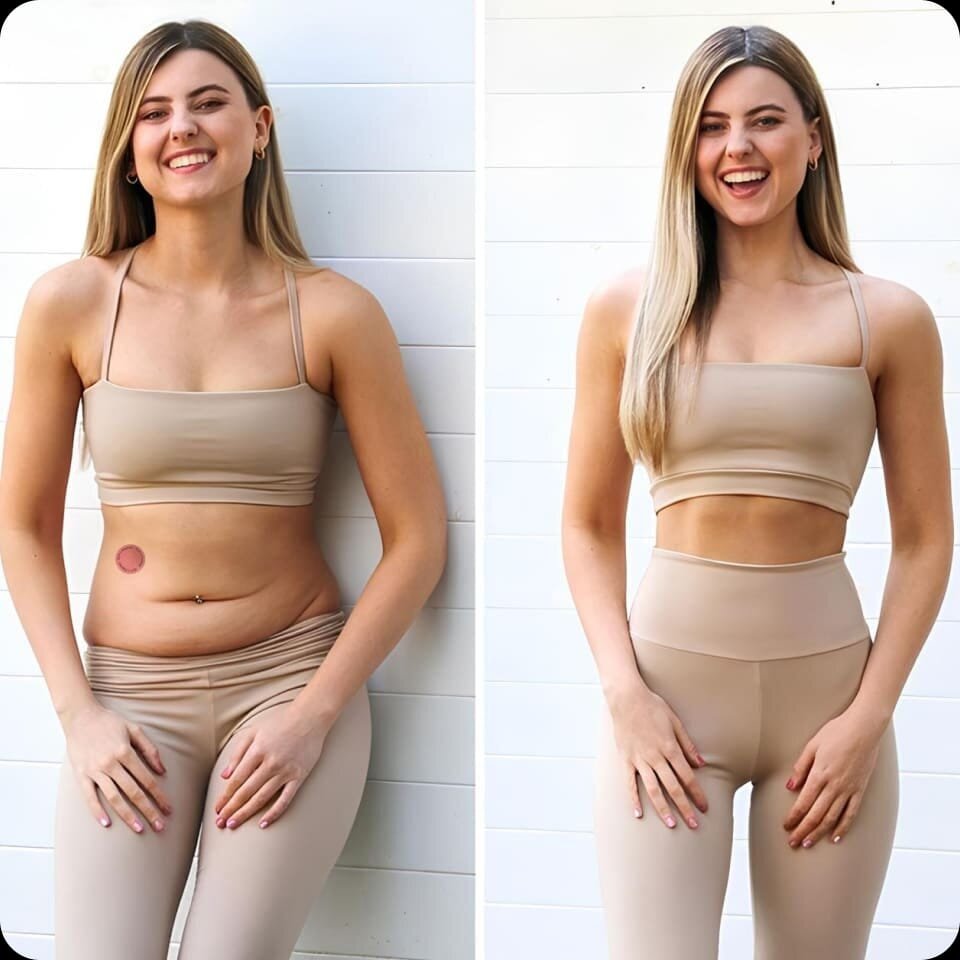Aurelia Slim lifestyle transformation